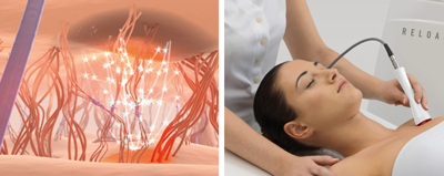 média: esthetique/soup-massageconjonctif2.jpg