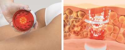 média: esthetique/soup-regenere.jpg